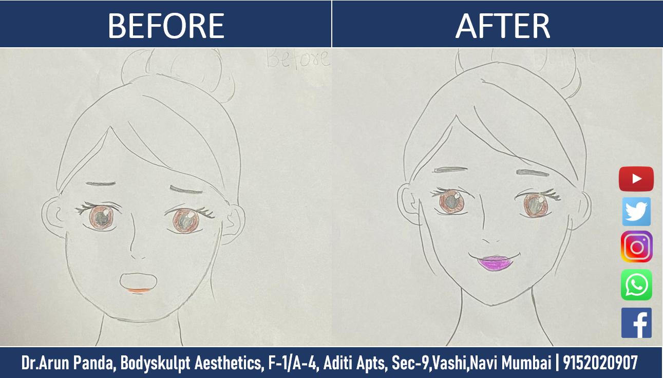 Jawline Surgeon in Mumbai