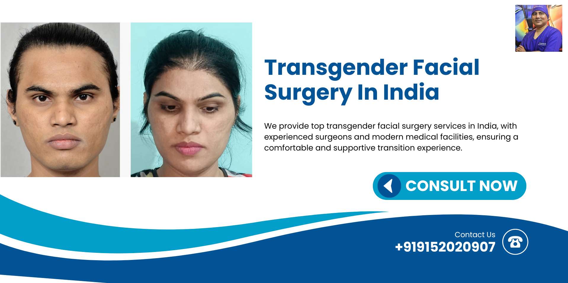 transgender facial transgender facial feminization surgery transgender facial surgery feminization transgender ffs transgender transgender facial feminization transgender feminization 