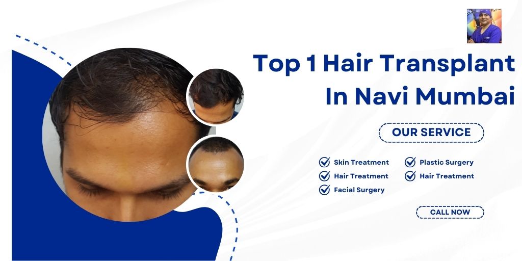Top 1 Hair Transplant In Navi Mumbai Hair transplant cost Navi Mumbai Best hair transplant in Navi Mumbai Best hair transplant in Mumbai Hair transplant in Kharghar Hair transplant clinic in Navi Mumbai Hair transplant cost Mumbai Top 10 hair transplant clinic in Mumbai Hair transplant Mumbai
